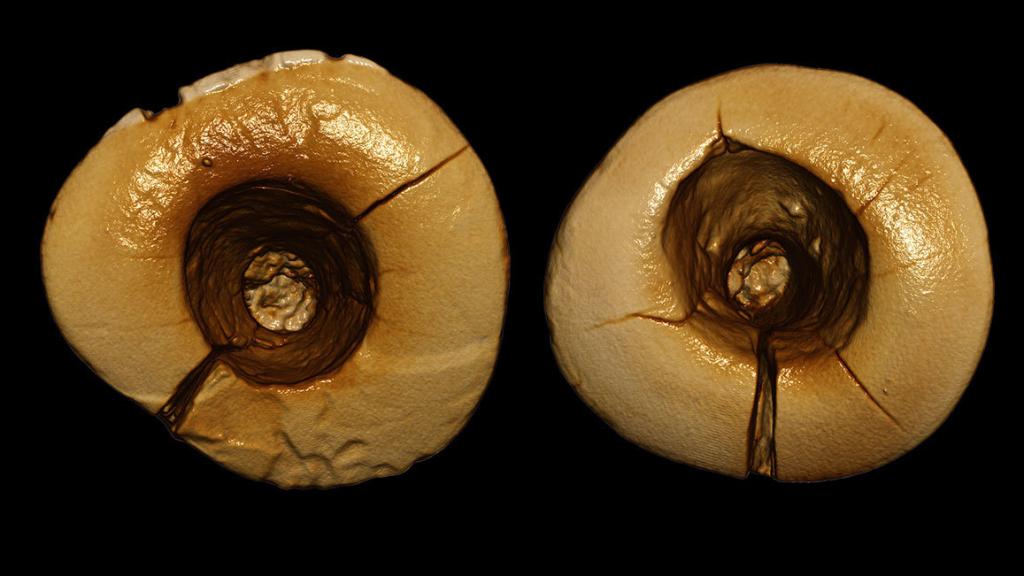 El relleno podría haber sido usado como antiséptico.