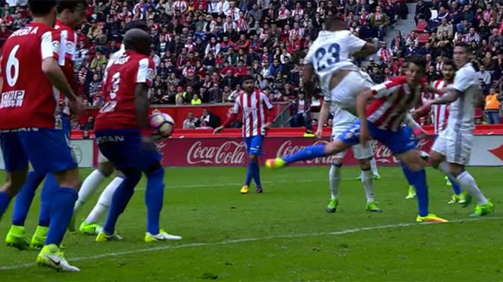 Mano de Babin en el área