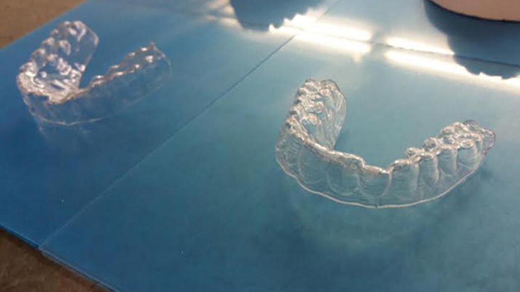 ortodoncia impresion 3d 1