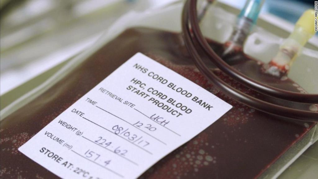 Una muestra de sangre de cordón umbilical