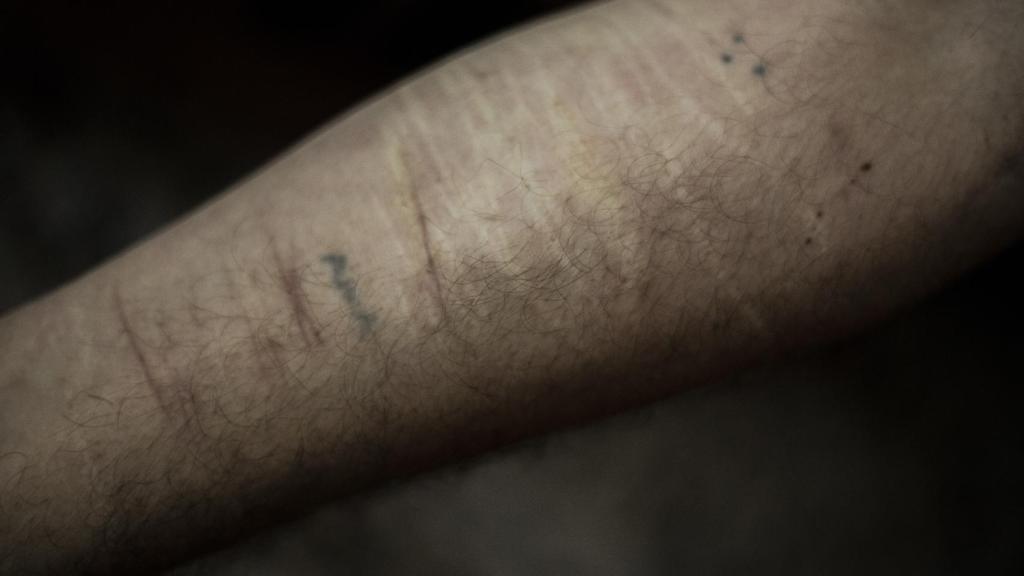 Durante su paso por la cárcel, Antonio Manuel sufrió ataques de otros presos que intentaron quitarle la vida. En sus brazos aún conserva las marcas de los cortes que le produjeron.