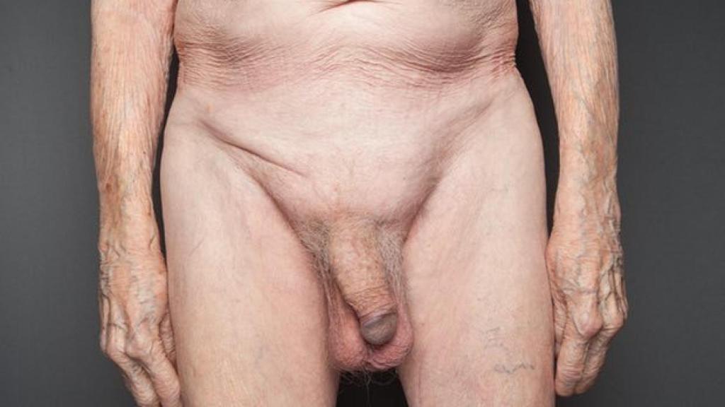 Uno de los penes fotografiados por Dodsworth, perteneciente a un hombre de 92 años.