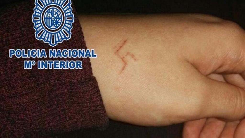 Imagen de la mano de la joven con la esvástica.