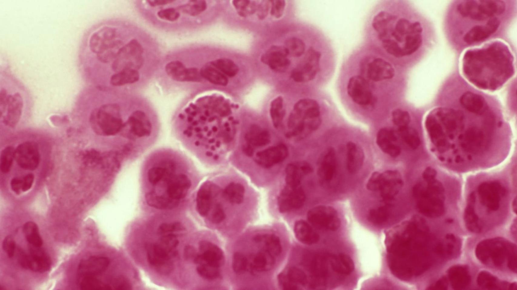 Imagen de Neisseria gonorrhoeae vista desde un microscopio.