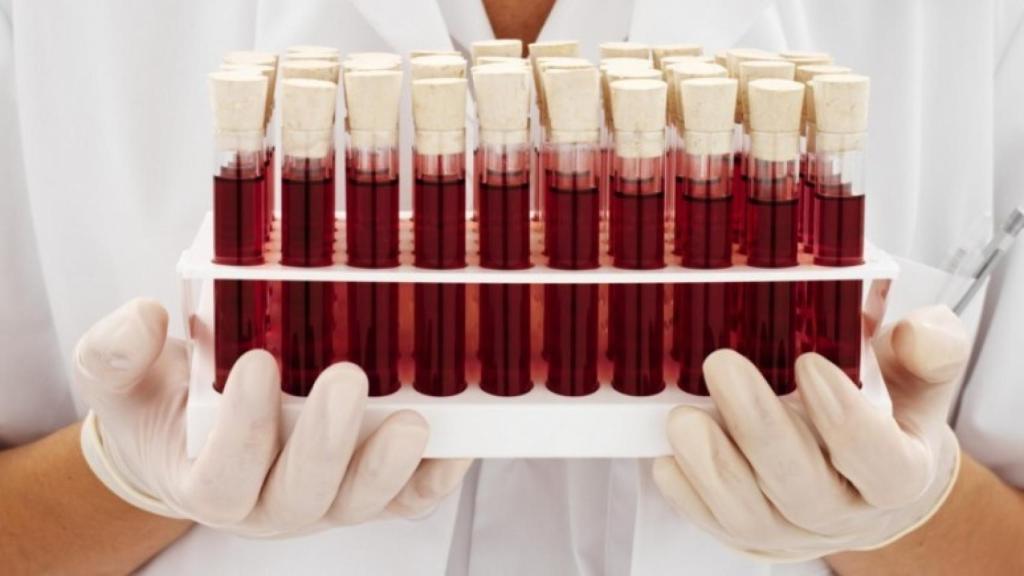Una sanitaria sostiene varias muestras de sangre.