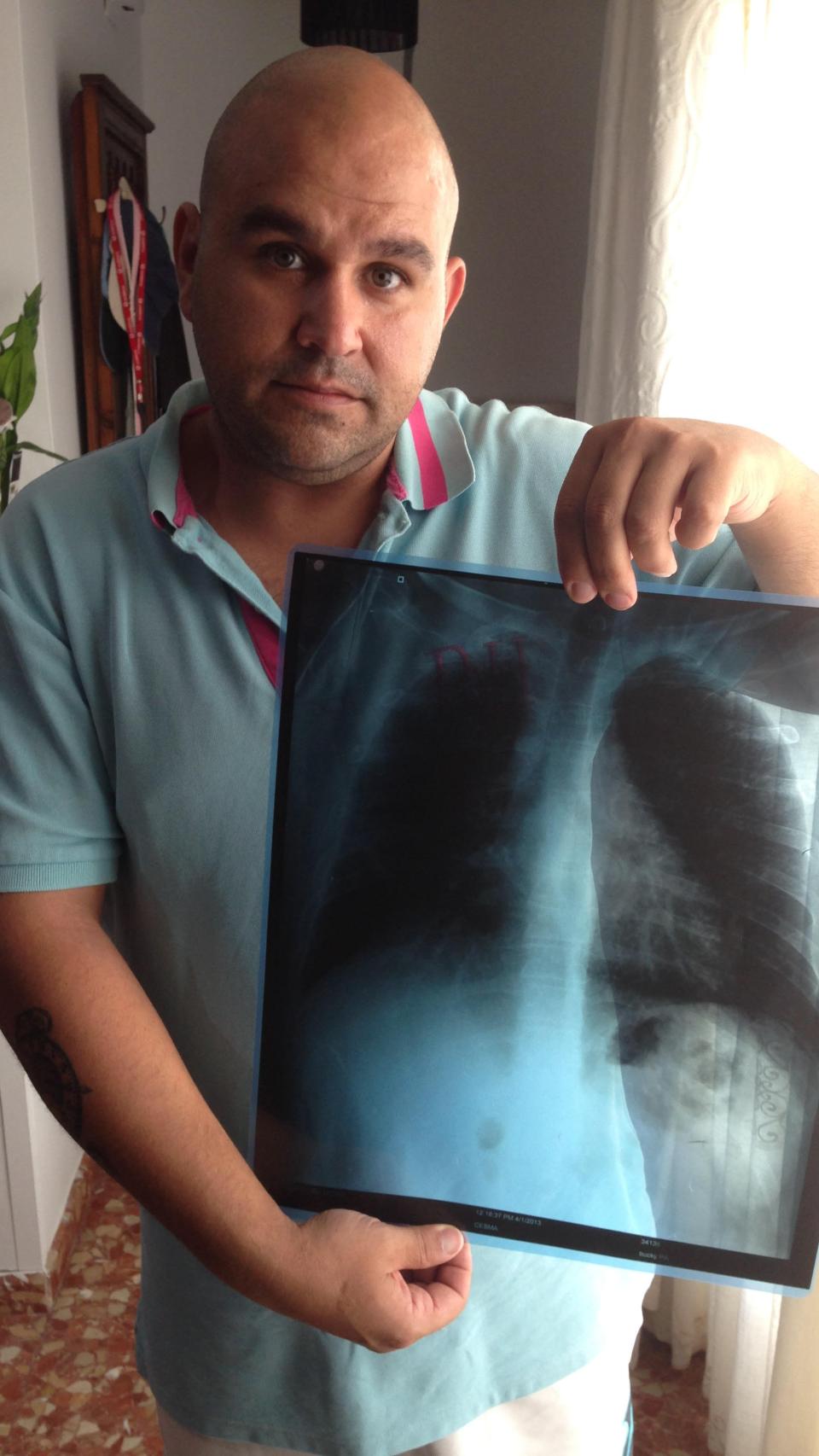 Miguel Córdoba padece de silicosis. Con 35 años cobra una pensión que no llega a 800 euros.