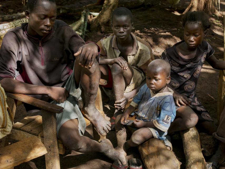 Más de 185.000 personas han abandonado el país debido a la guerra.