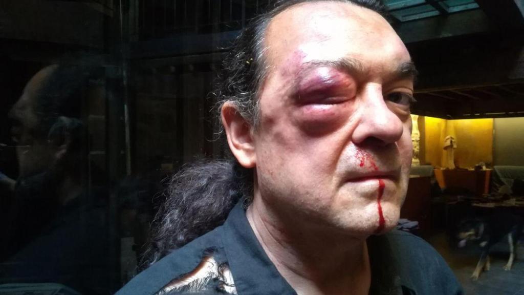 Fernando Barredo, tras ser agredido.