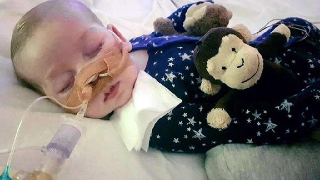 Charlie Gard, intubado.