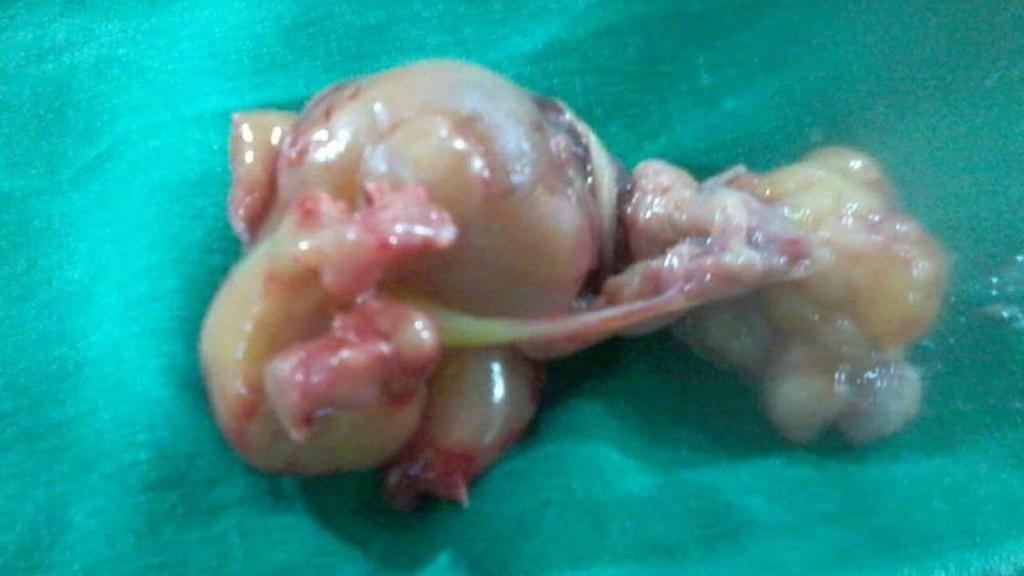 La masa de siete centímetros