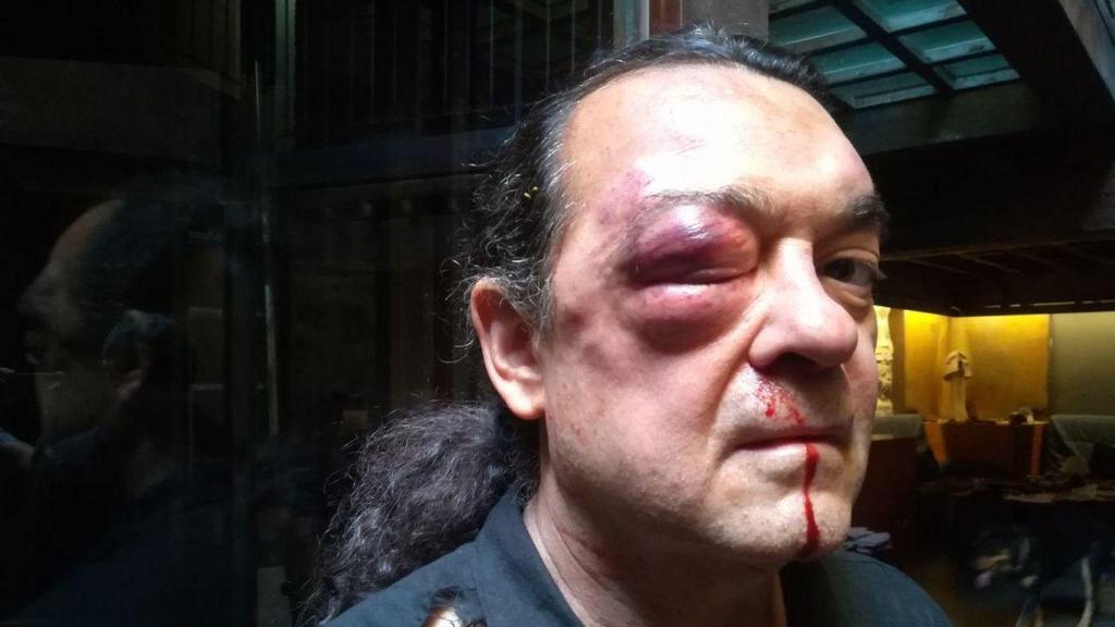 Fernando Barredo, después de la agresión que sufrió