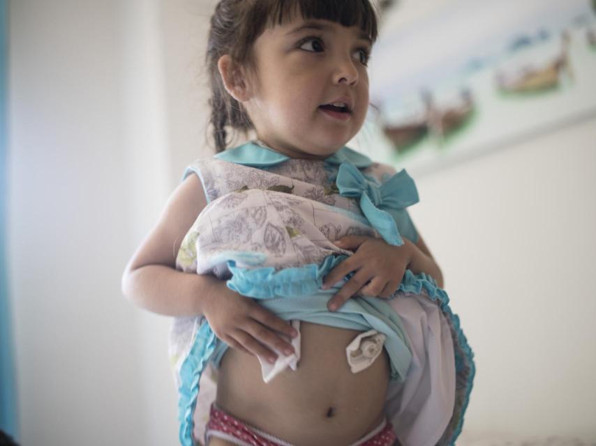 El Síndrome Nefrótico Congénito Finlandés es una patología ultra rara en España.