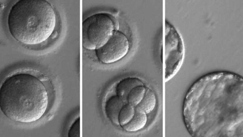 Image: Hitos de la edición génica