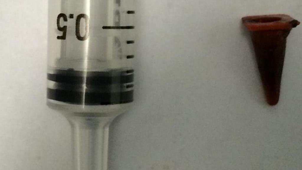 A la derecha, el minúsculo cono de Playmobil que se tragó el paciente.