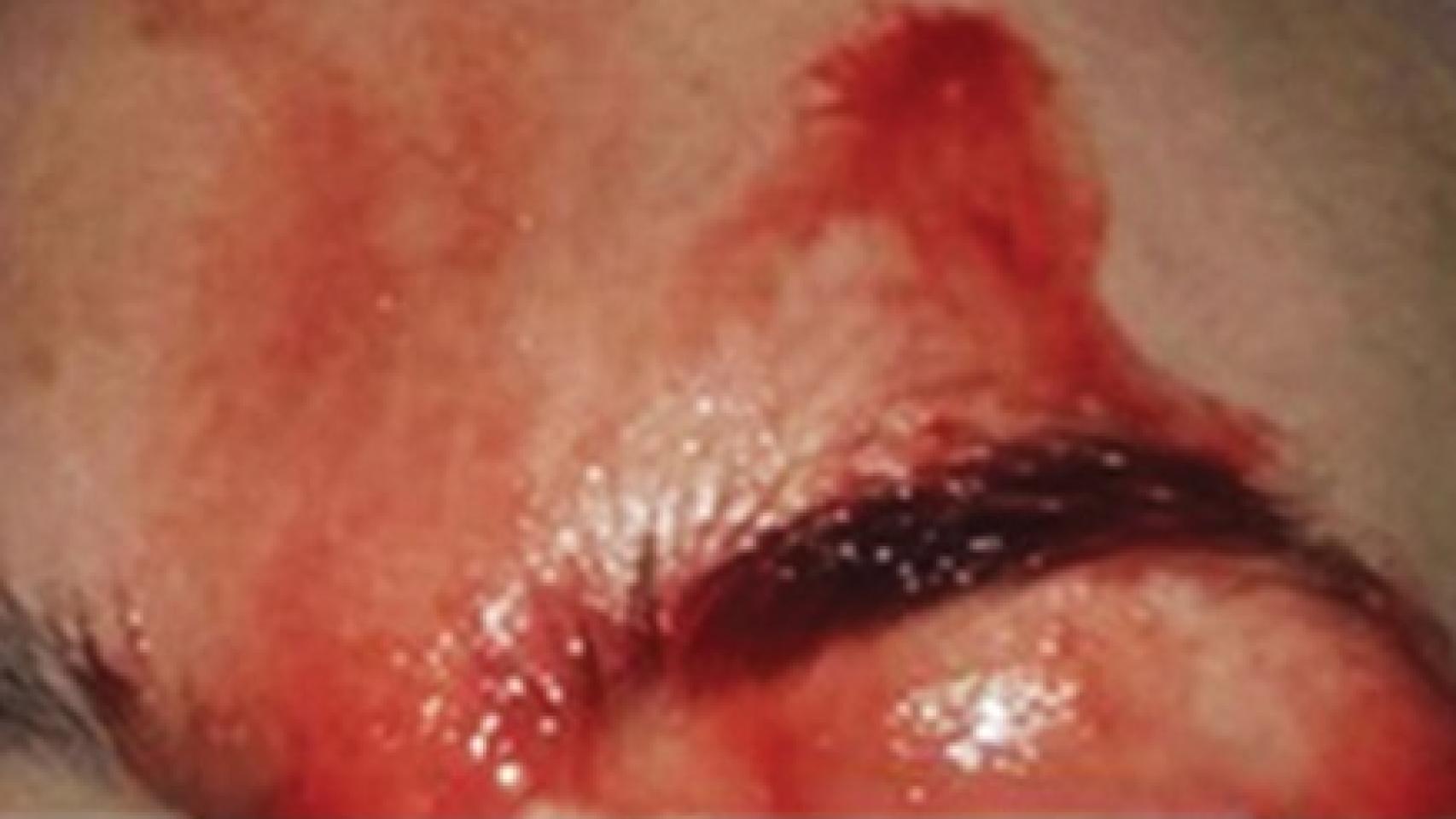 Imagen del rostro de la paciente.