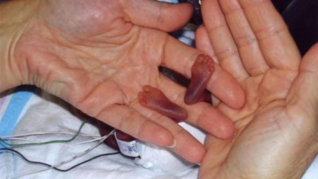 Los piececitos de Amilia.