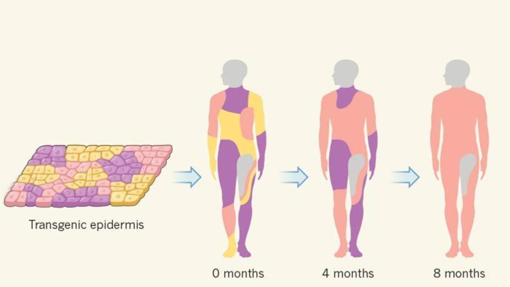 Las tres operaciones por las que pasó el niño.