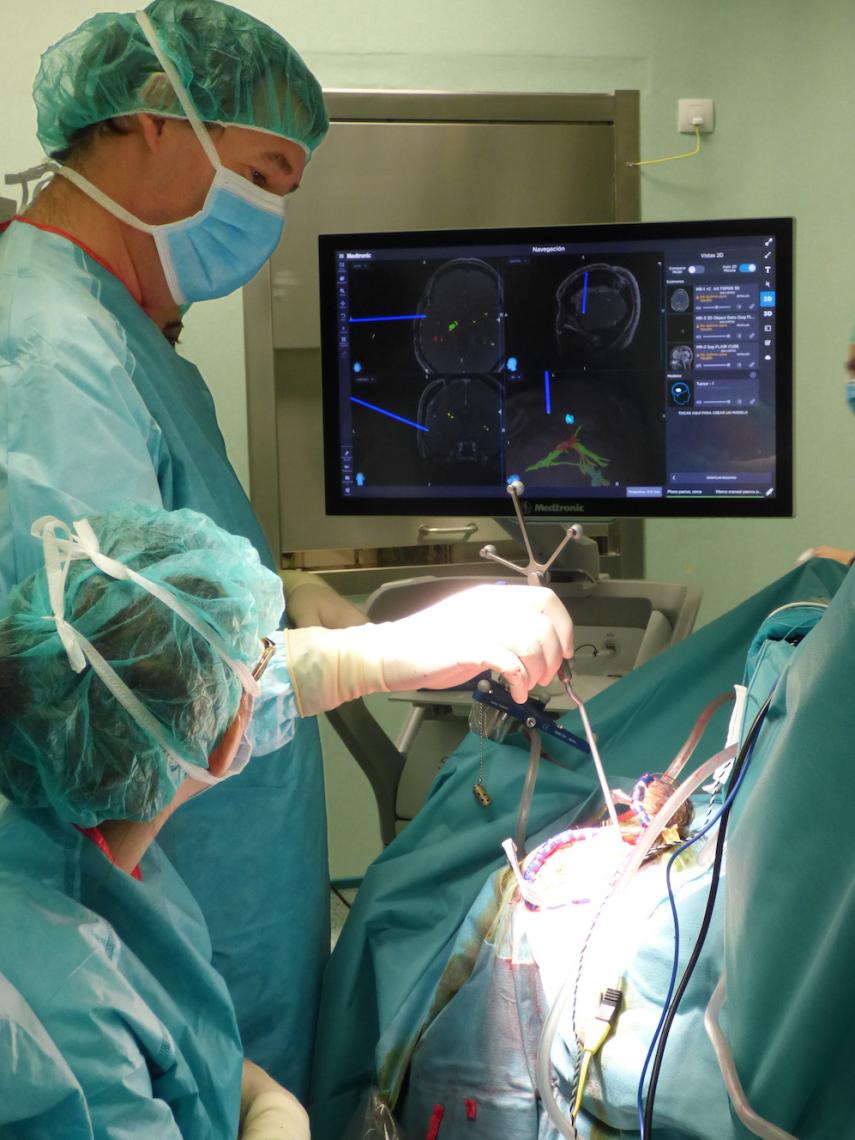 Los neurocirujanos pueden navegar por el cerebro del paciente en tiempo real