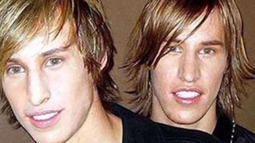 Mike y Matt Schlepp, despues de pasar por el quirófano.