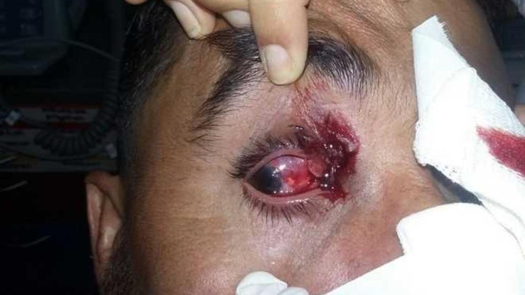 Ojo de uno de los futbolistas.