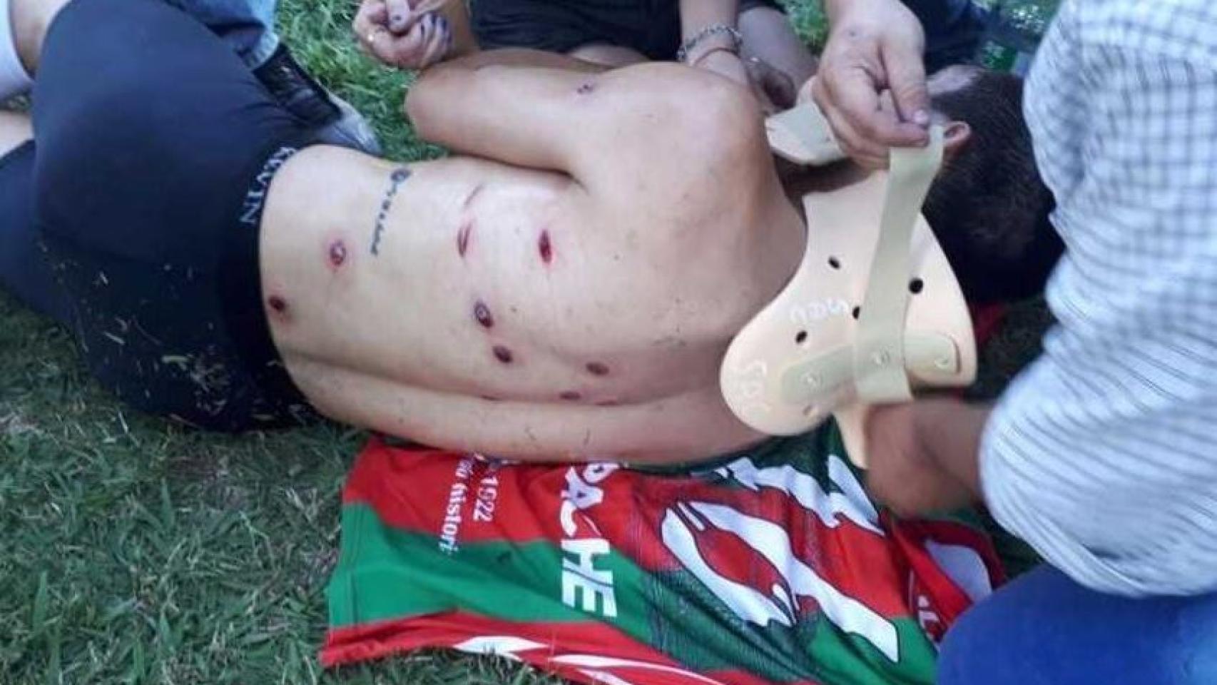 Un futbolista, tirado en el suelo tras la represión.