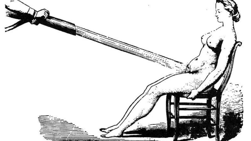 Una ducha pélvica a presión, uno de tantos remedios para la histeria.