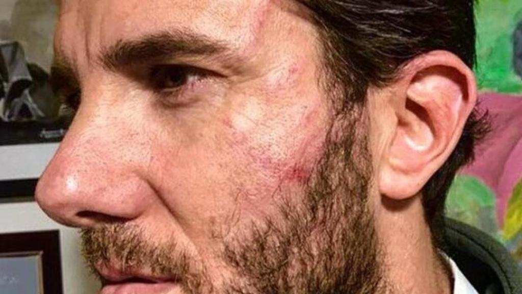 Las secuelas de Israel tras la agresión.