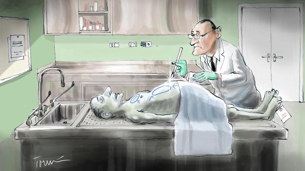 El preso 'resucitado' tenía el cuerpo con marcas tintadas para realizarle la autopsia