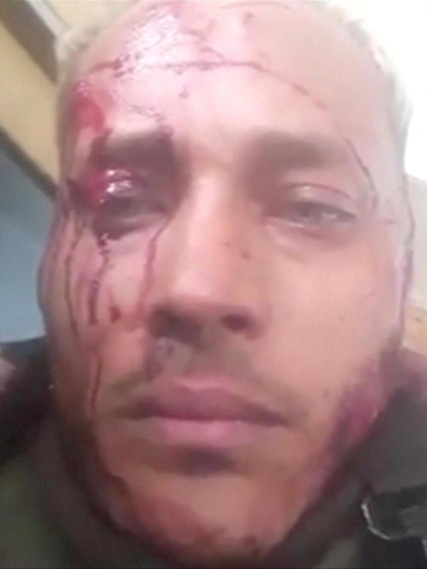 El piloto Óscar Pérez, herido