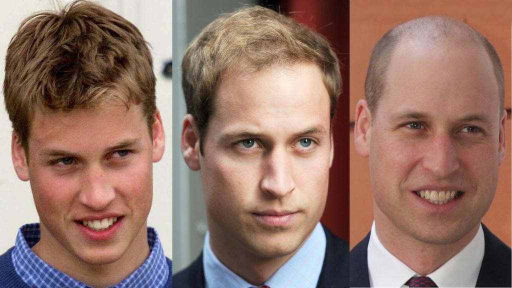 El cambio del príncipe Guillermo. De izq. a dcha: año 2000. 2008 y enero de 2018.