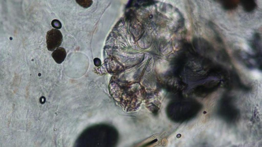 El parásito causante de la sarna.