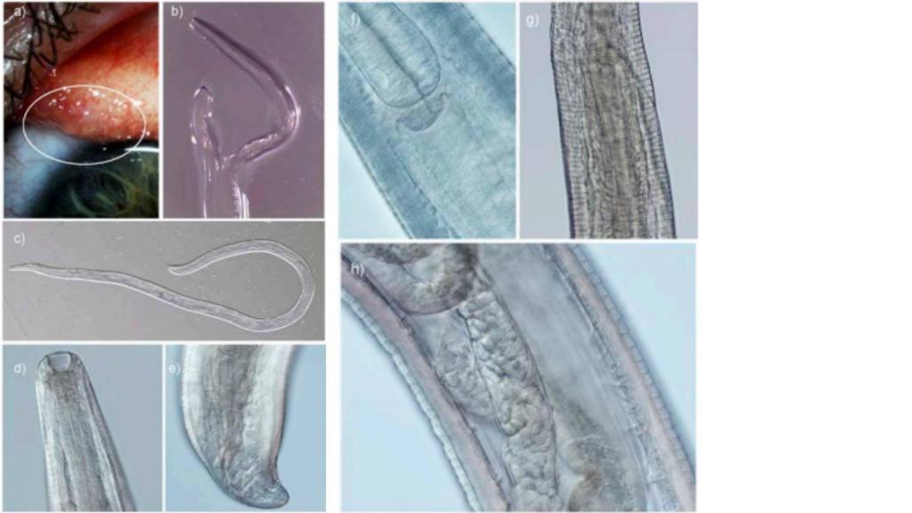 Los Thelazia gulosa extraídos de los ojos de Beckley