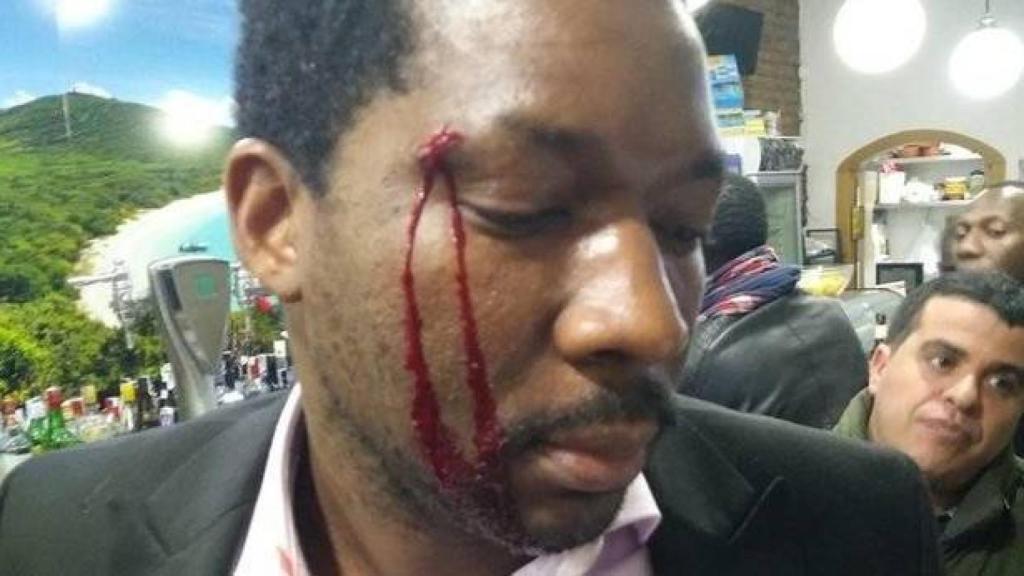 Una mujer agrede al actor Marius Makon: “No quiero negros en el local.