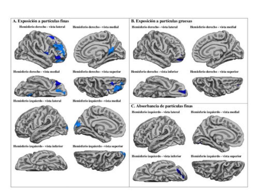 En la imagen, las regiones cerebrales afectadas por las partículas finas y gruesas.