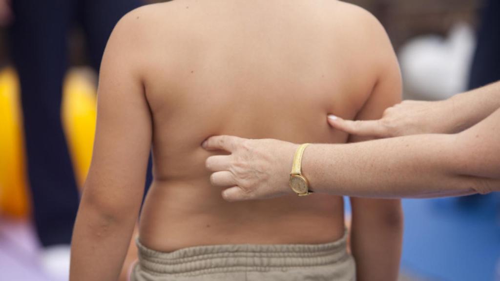 La obesidad infantil es un problema de salud pública.