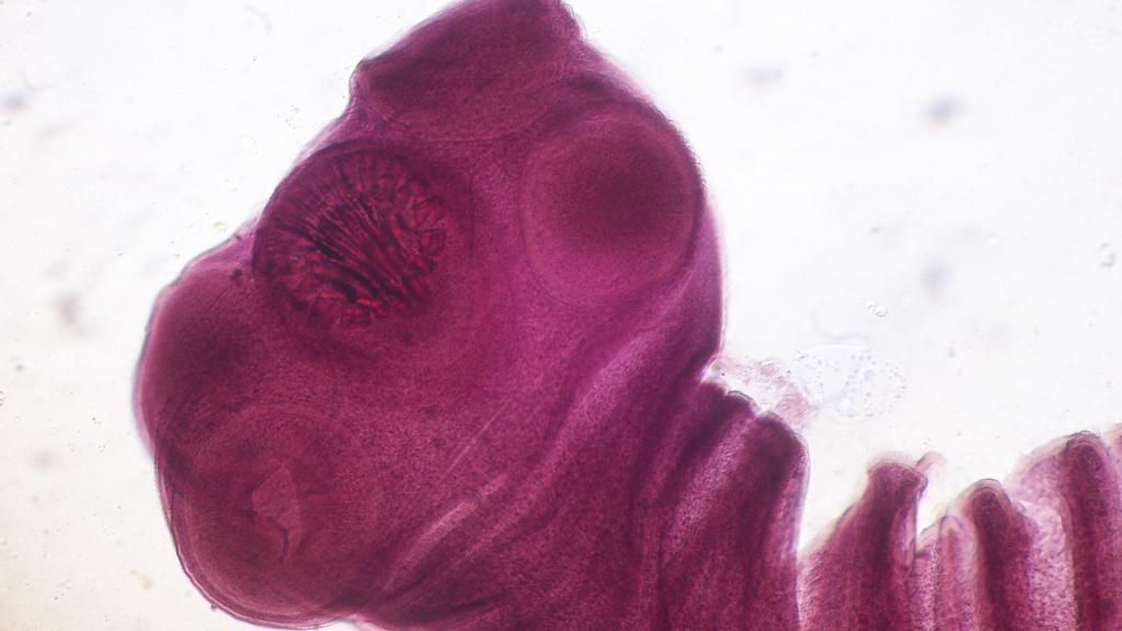 La cabeza del parásito Taenia Solium.