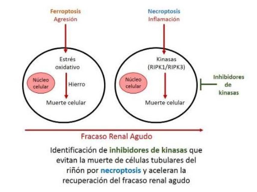 La administración de inhibidores de quinasas es el nuevo tratamiento que proponen los doctores del Hospital Universitario Fundación Jiménez Díaz