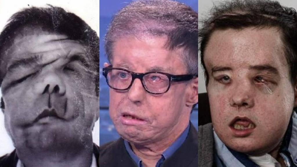 Las tres caras de Jérôme Hamon.