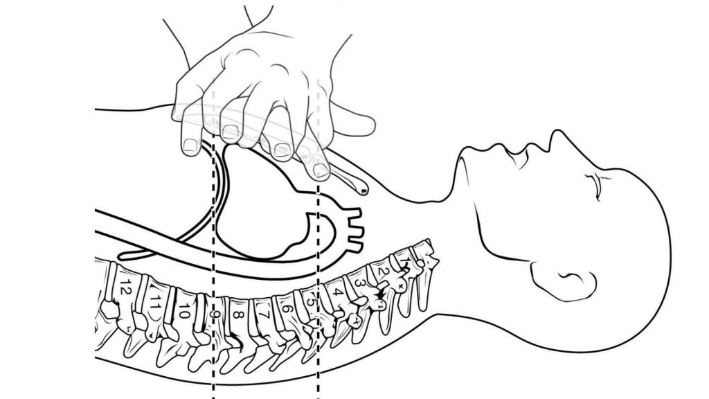 Cómo y dónde colocar las manos para la compresión cardíaca.