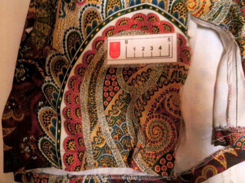 El vestido que la joven llevaba aquel día quedó con rasgaduras. Al llegar a casa, confundida y sin saber lo que le había ocurrido, le hizo fotos a la ropa que vestía.