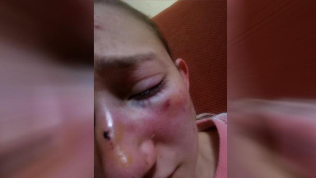 La agresión tuvo lugar la madrugada del día 21 en A Coruña