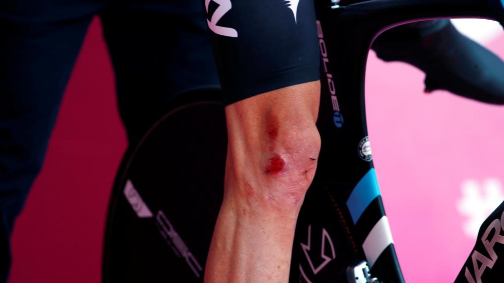 Las heridas de Froome tras caerse antes del prólogo.