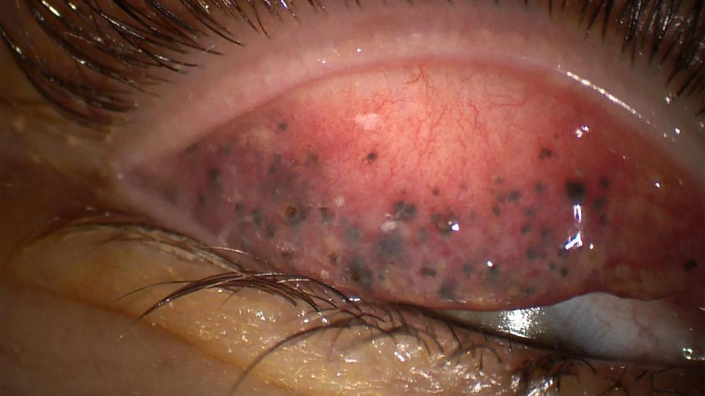 El rímel se había acumulado con los años bajo los párpados de la mujer.