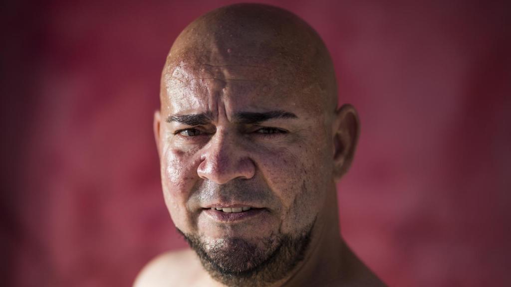 El chiclanero Luis Rodríguez Guerrero lleva más de un año con un riñón donado por su hermano.