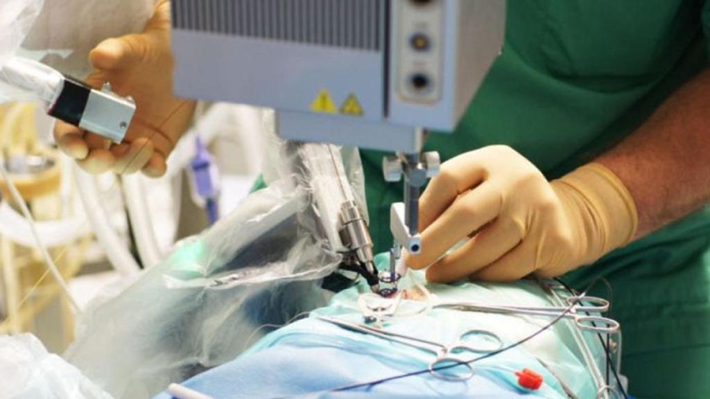 robot cirugia ocular operacion ojo PRECEYES