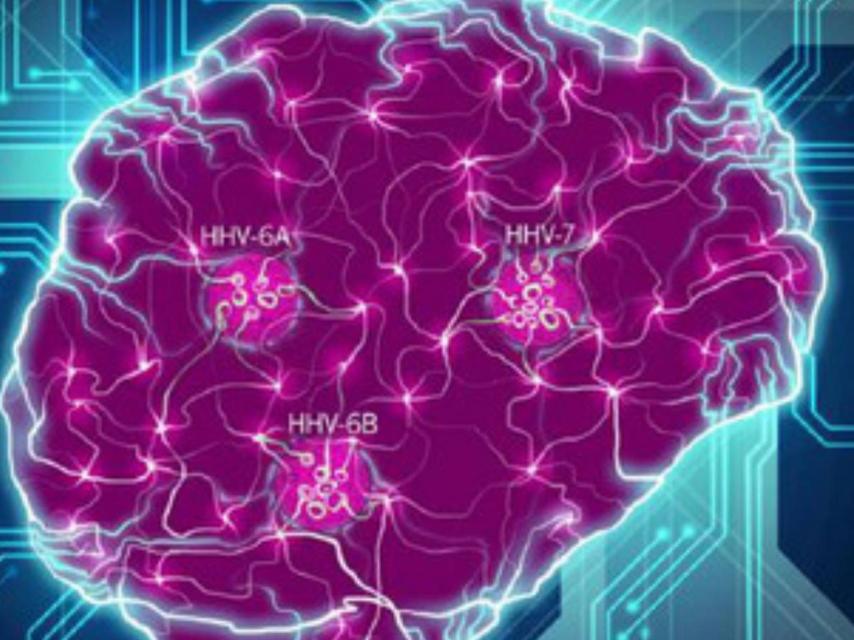 Virus que afectan al cerebro.
