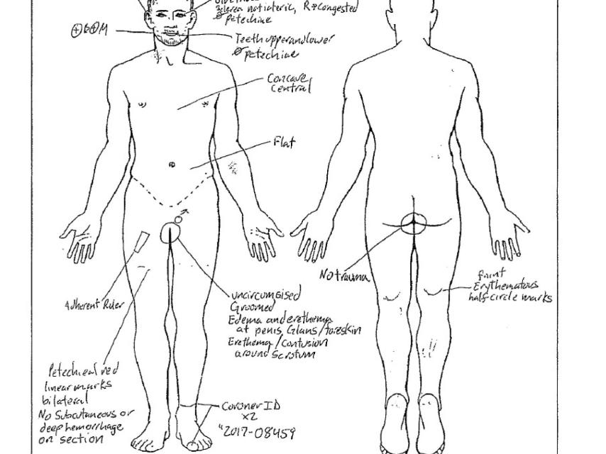 Imagen de la autopsia del profesor que falleció durante la sesión de Skip Chasey.
