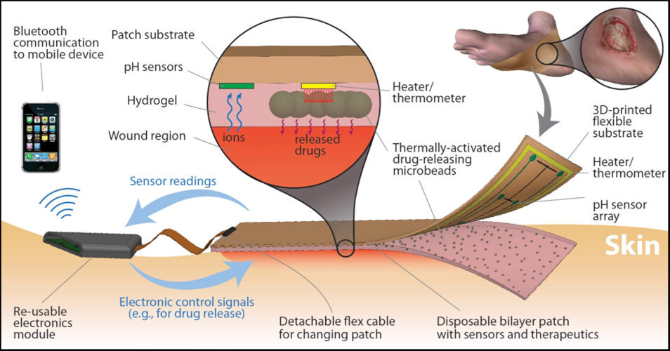 vendaje inteligente 2