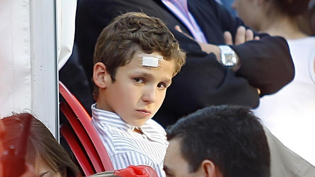 Froilán con una herida en la frente.