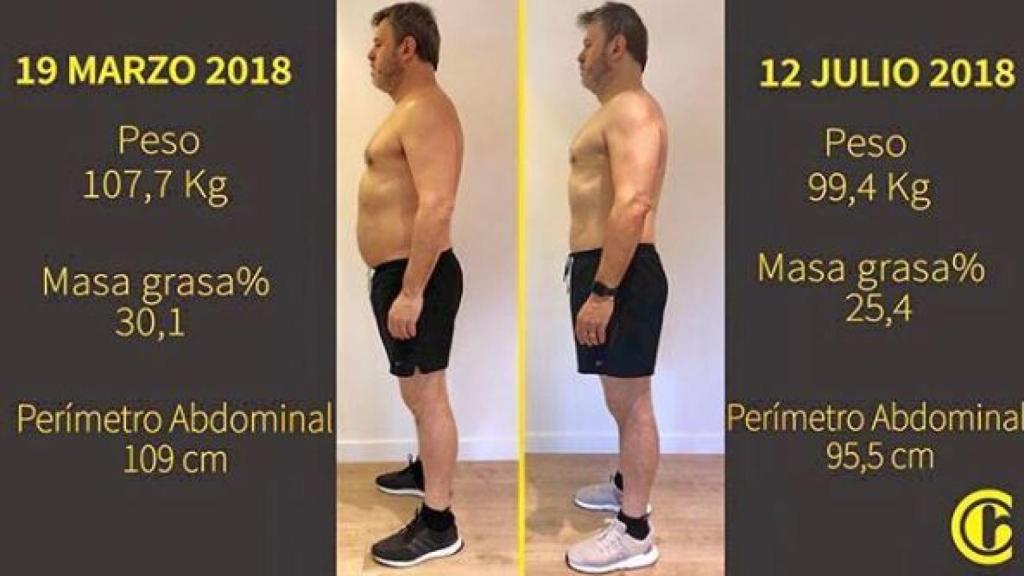 El antes y el después de Miki Nadal.